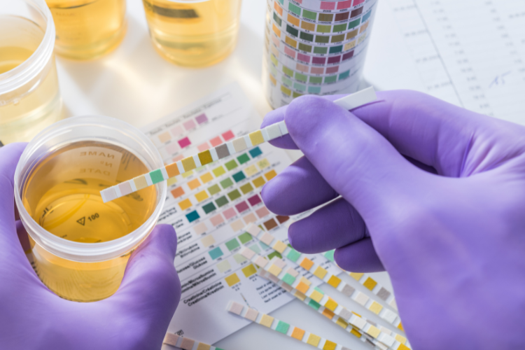 Does Urine Color Reveal Our Hydration Status?